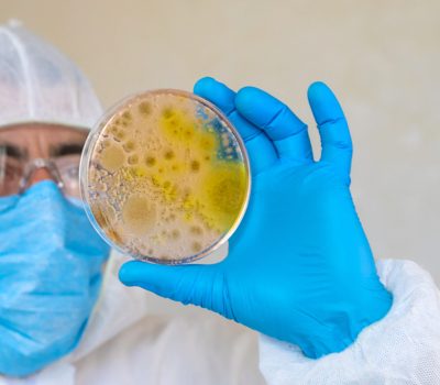 Examine bacteria in petri dishes in the laboratory. Selective focus. nature.